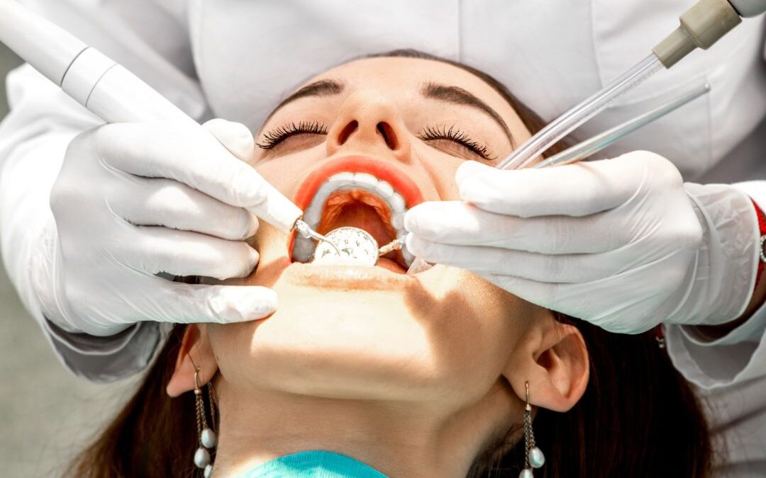 Quanto dura la pulizia dei denti professionale del dentista ?